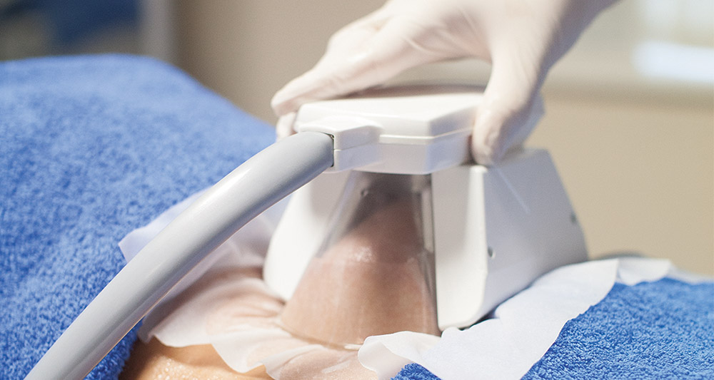 How Fat Freezing and HIFU Work Together? 2 Multiple Areas in One Session HIFU and Fat Freezing Watford