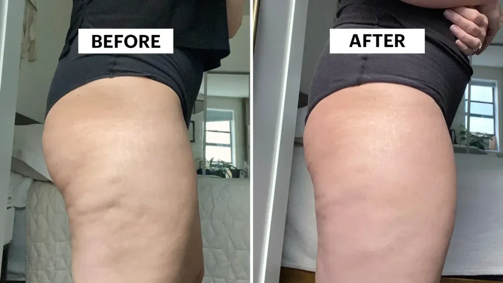 Do Toning Exercise Watford Really Tackle Cellulite?
