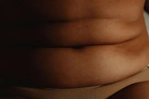 The Hidden Connection: How Stress Shapes Your Fitness and Body Composition 3 image of what stress can do on the stomach area and how Lipo 360 Watford can help to change your body shape.