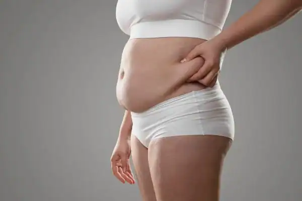 Image of stress belly Watford How Lipo 360 can help manage your symptoms
